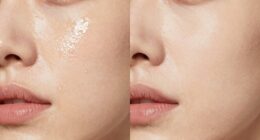 hydration versus moisturizing differences