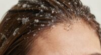 scalp exfoliation simplifies care