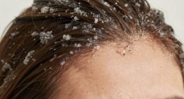 scalp exfoliation simplifies care